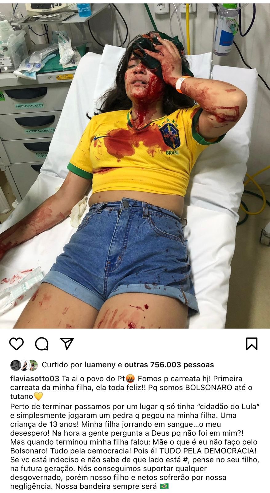 Adolescente de 13 anos é atingida por pedra em carreata do Bolsonaro