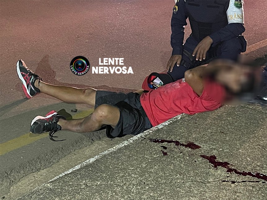 VÍDEO - Homem tem perna quebrada em atropelamento na capital - IMAGENS FORTES