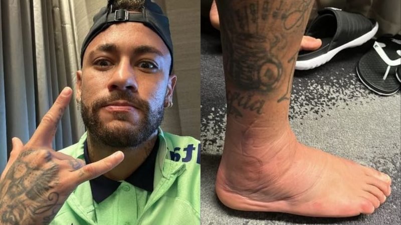 Neymar Jr impressiona ao mostrar tornozelo durante tratamento contra lesão
