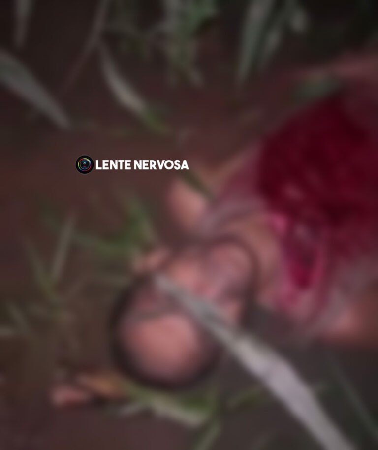 IMAGENS FORTES: Onça ataca caseiro de sítio e deixa coração exposto – VEJA O VÍDEO