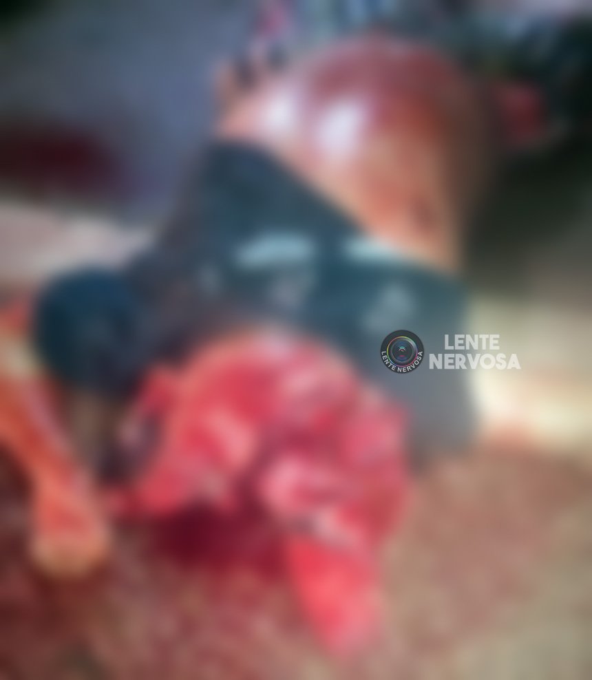 IMAGENS FORTES: Cérebro de homem é lançado para fora da cabeça após duplo atropelamento em Porto Velho - VÍDEO