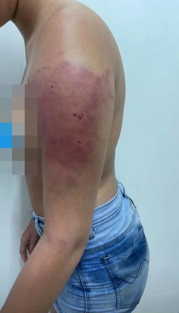 Mulher é espancada pelo namorado por beber cerveja “sem permissão”