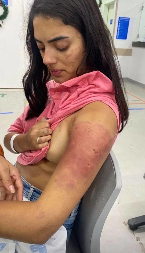 Mulher é espancada pelo namorado por beber cerveja “sem permissão”