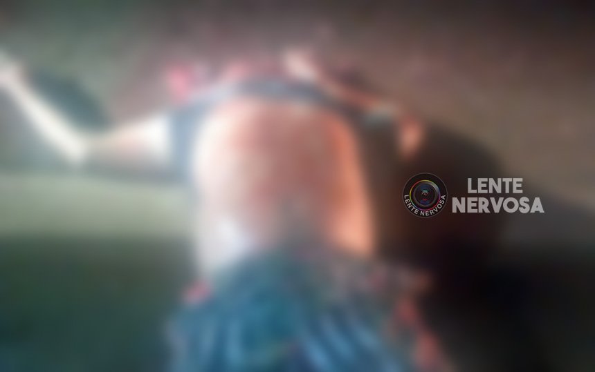 IMAGENS FORTES: Cérebro de homem é lançado para fora da cabeça após duplo atropelamento em Porto Velho - VÍDEO