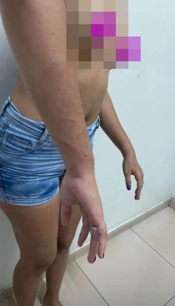 Mulher é espancada pelo namorado por beber cerveja “sem permissão”