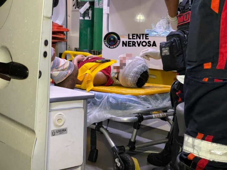 Últimas Notícias 7 URGENTE – Criança fica gravemente ferida ao ser atropelada por carro após acidente