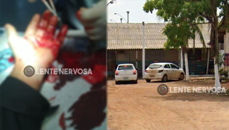 Últimas Notícias 3 Agente fica com mão dilacerada ao tentar evitar fuga em unidade de internação na capital