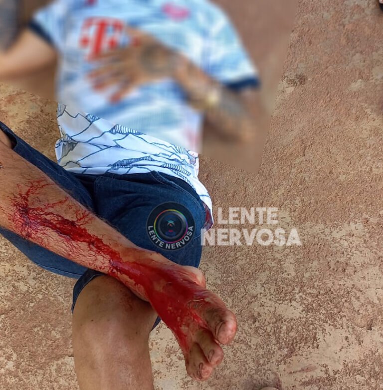 URGENTE – Homem é baleado em tentativa de homicídio na zona leste