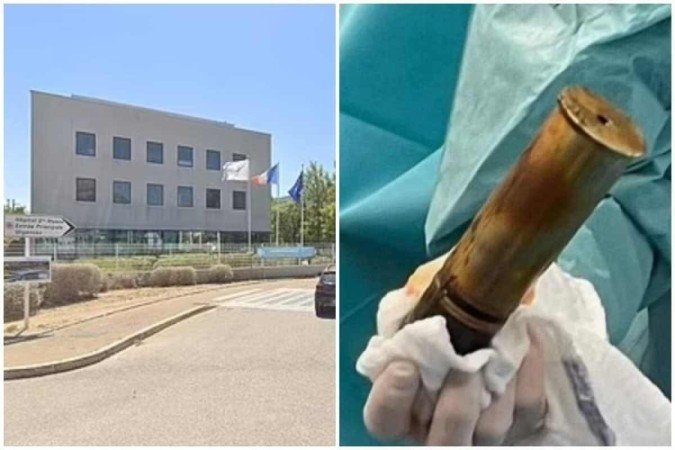 Homem faz hospital ser evacuado ao chegar no local com bomba no ânus 1 Homem faz hospital ser evacuado ao chegar no local com bomba no ânus