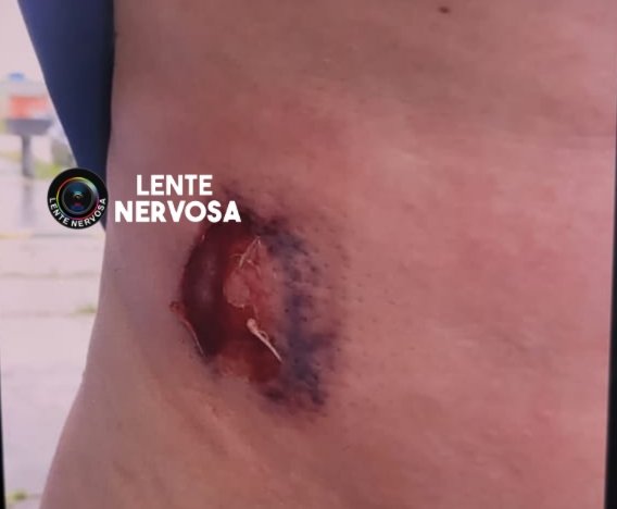 Vigilante se mata após trocar tiros com policiais militares na zona sul 3 Vigilante se mata após trocar tiros com policiais militares na zona sul