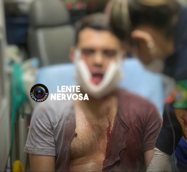 Homem é baleado na cabeça na zona leste da capital