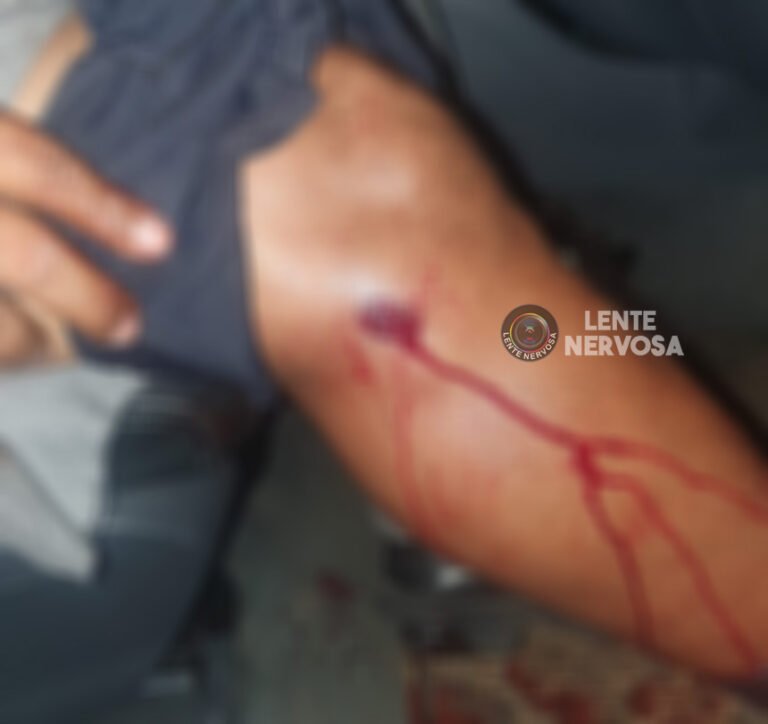 URGENTE – Troca de tiros em fazenda resulta em policial militar baleado