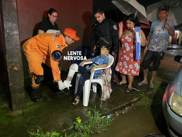 Últimas Notícias 9 Criança quebra a perna ao ser atropelada por motorista embriagado na zona sul – VÍDEO