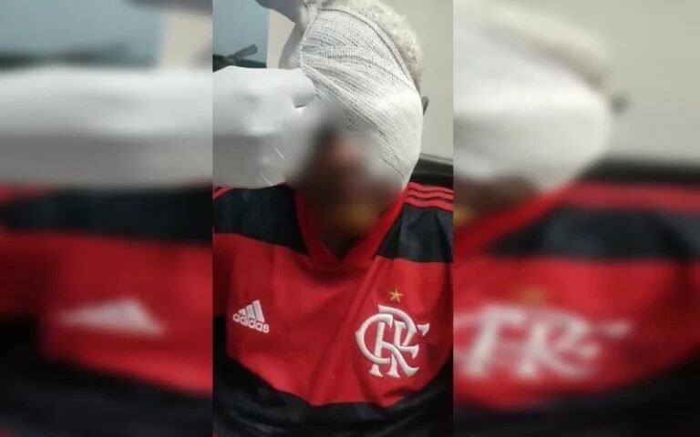 Jovem autista perde olho após ser espancado em jogo de futebol