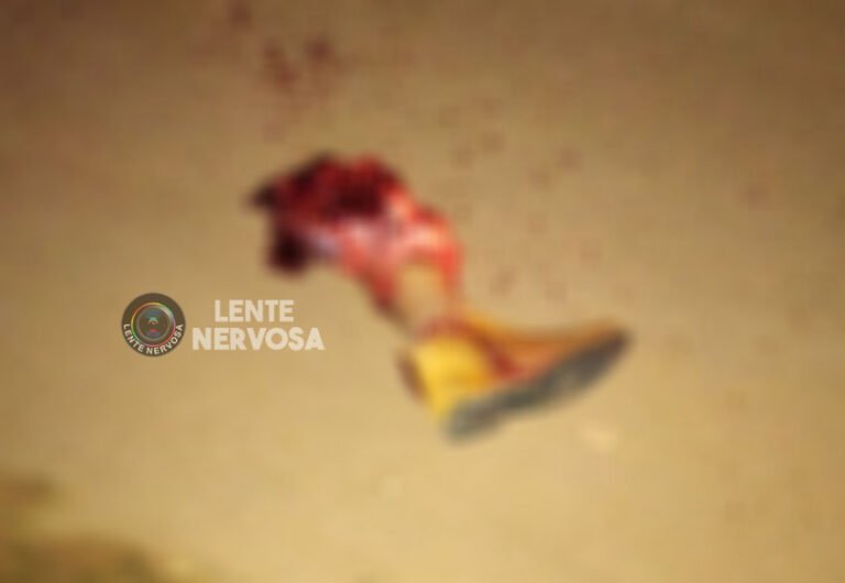 Últimas Notícias 10 Motociclista tem perna arrancada em grave acidente na zona leste – VÍDEO