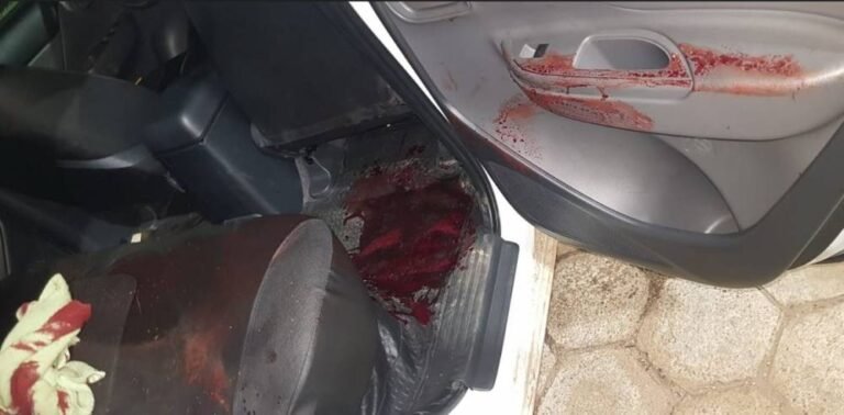 Caminhoneiro que teve rosto desfigurado após explosão do pneu de carreta é transferido para Porto Velho