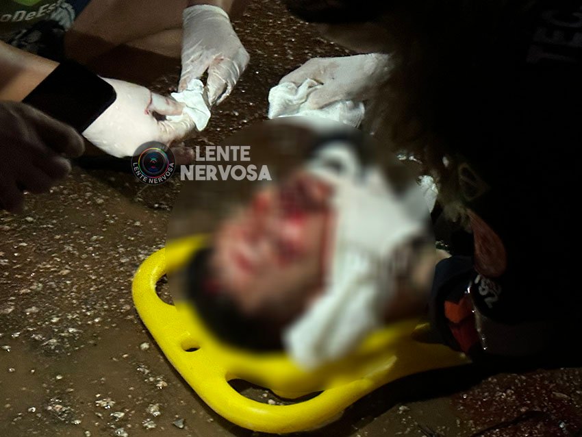 GRAVE: motoboy fratura mandíbula e nariz ao colidir em carro que invadiu preferencial – VÍDEO