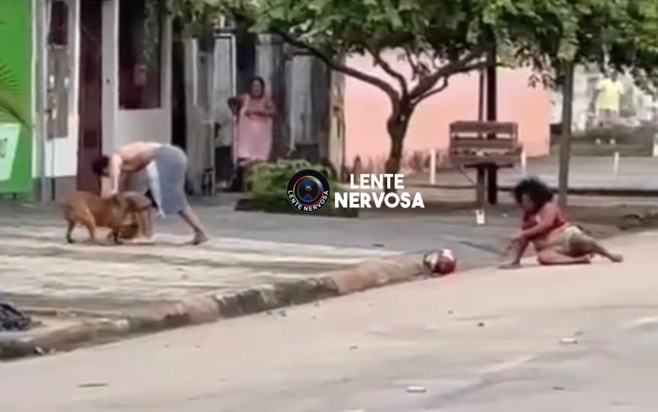 Cães da raça pitbull arrancam couro cabeludo de mulher durante ataque em Porto Velho – IMAGENS FORTES