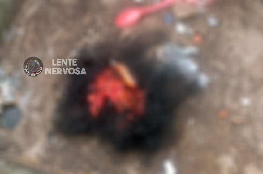 Cães da raça pitbull arrancam couro cabeludo de mulher durante ataque em Porto Velho – IMAGENS FORTES