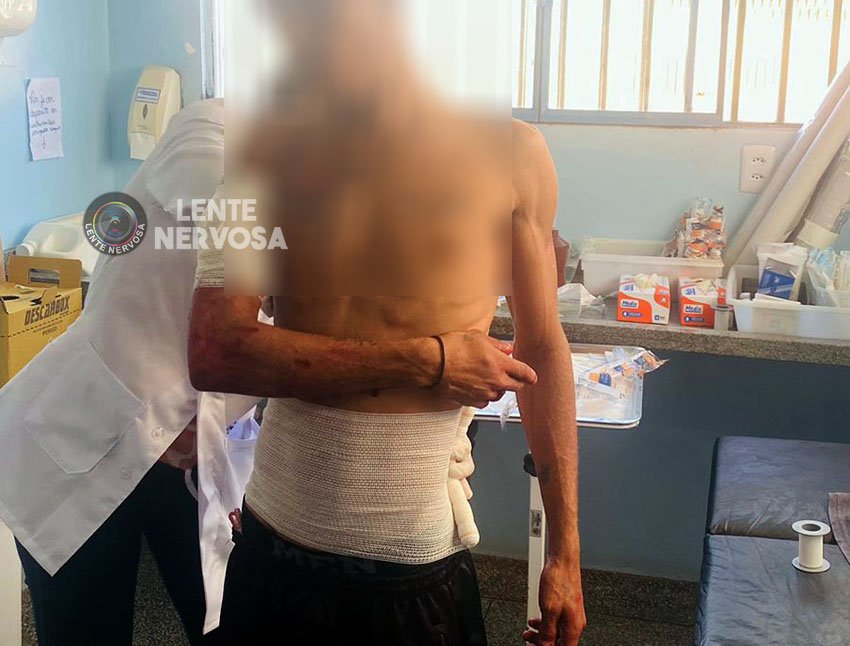 Jovem quase tem o braço decepado em ataque com facão na zona leste - VEJA FOTOS