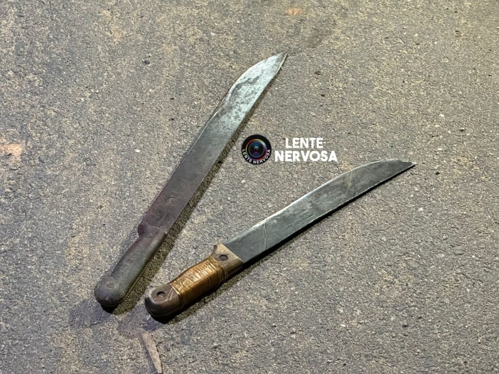 Mulher fica gravemente ferida ao ser atacada a golpes de facões pelo ex-marido 2 Mulher fica gravemente ferida ao ser atacada a golpes de facões pelo ex-marido