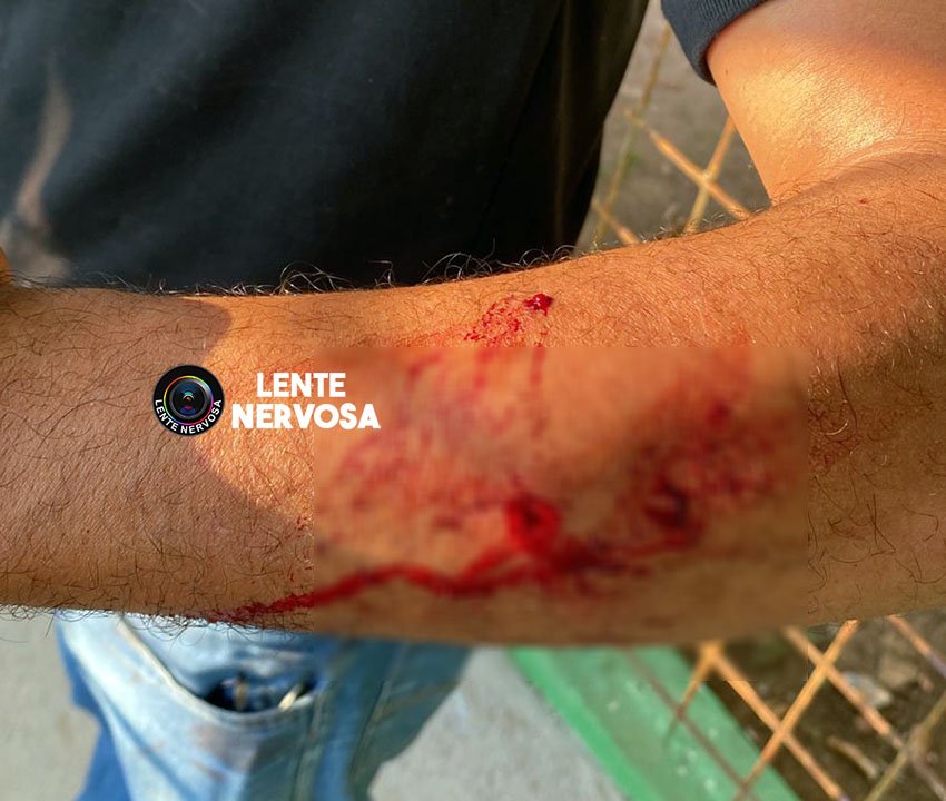 Servidor tem olho furado durante ataque e fuga de adolescentes na capital