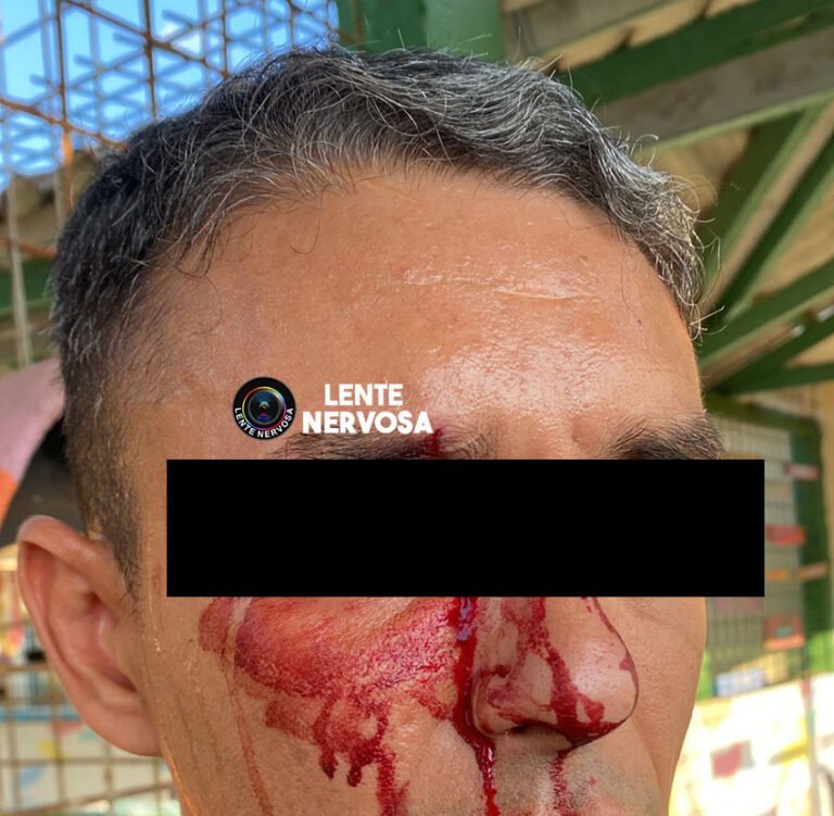 Servidor tem olho furado durante ataque e fuga de adolescentes na capital
