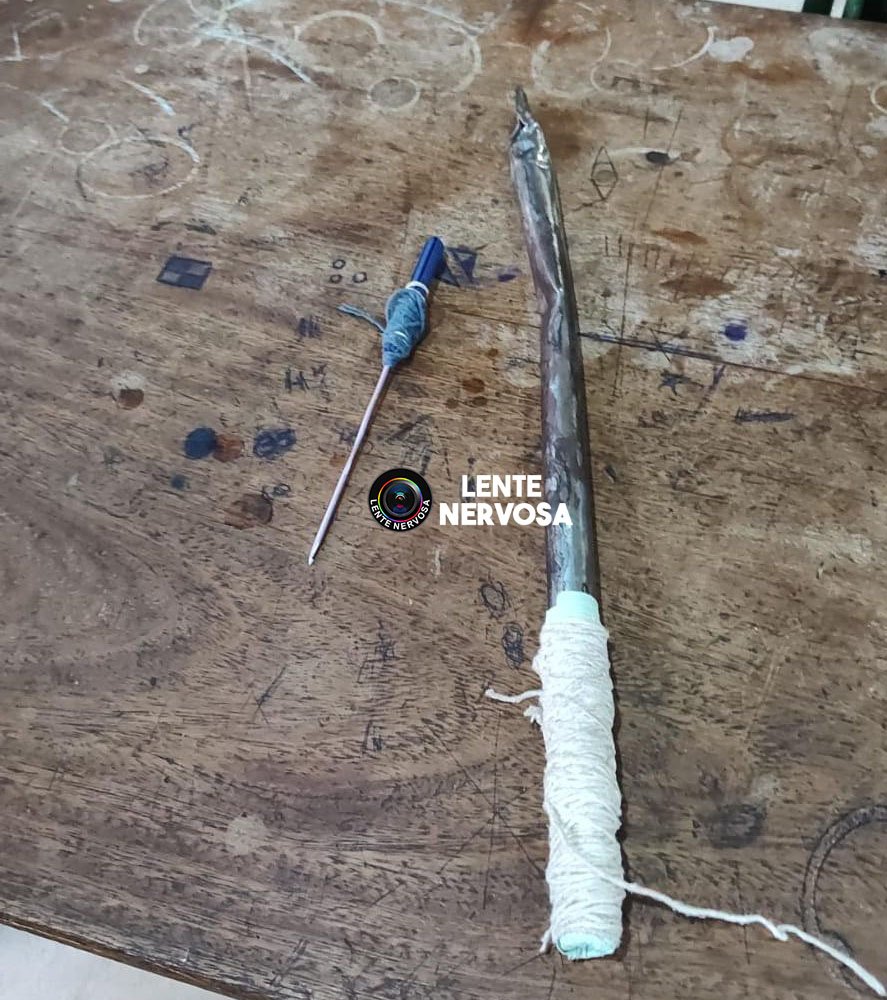 Servidor tem olho furado durante ataque e fuga de adolescentes na capital