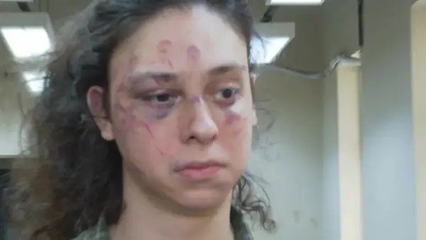 Ator Victor Meyniel é espancado no Rio; defesa alega homofobia - VEJA O VÍDEO