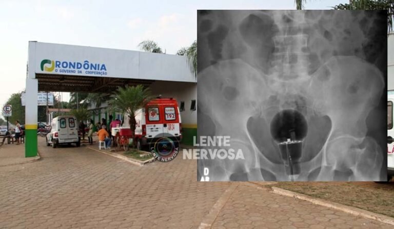 Foragido por estupro é preso ao pedir ajuda em posto da PRF por estar com lâmpada quebrada no ânus