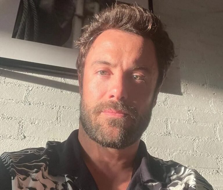 Ator Kayky Brito fica gravemente ferido em atropelamento no Rio de Janeiro