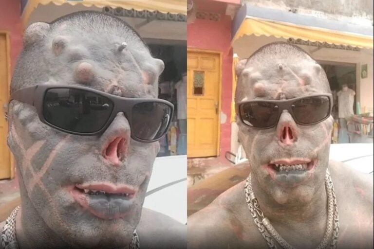 “Diabão” arranca mais dois dedos em projeto para ter “garras” – VEJA FOTOS