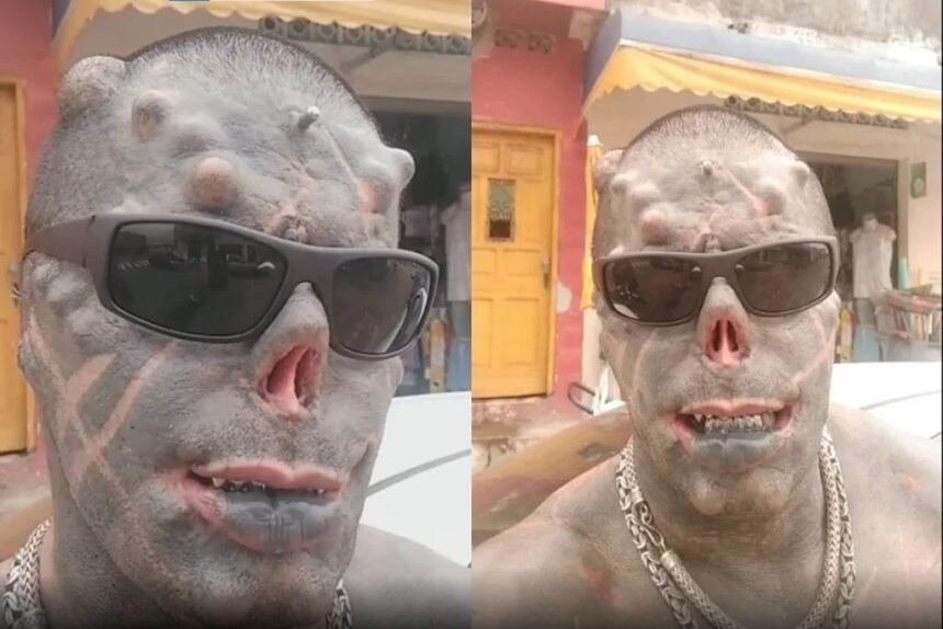 “Diabão” arranca mais dois dedos em projeto para ter “garras” - VEJA FOTOS