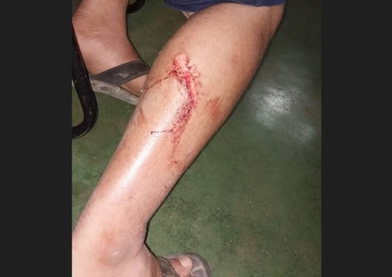 Últimas Notícias 6 Guia Turístico Registra Queixa na Polícia após Ataque com Zagaia por Vice-Prefeito de Pimenteiras do Oeste