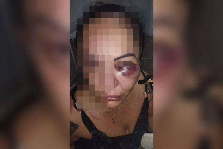 Homem agride, enforca e desfigura rosto de mulher