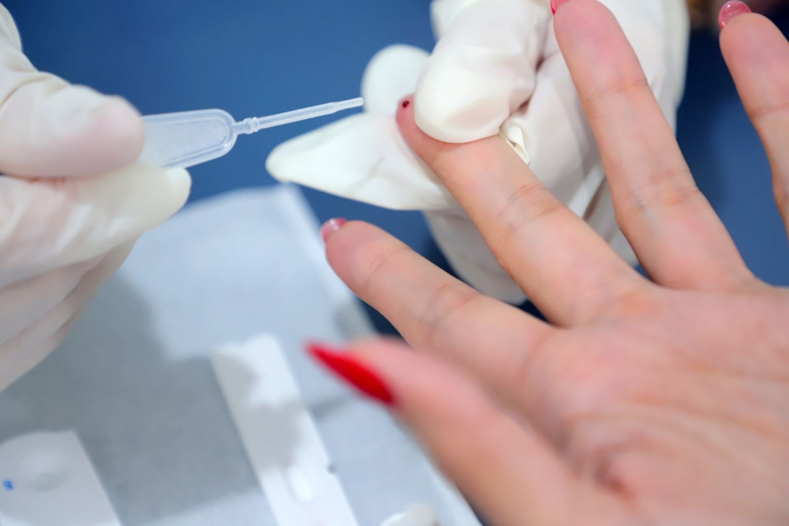 Medicamentos que previnem o HIV estão disponíveis na rede pública municipal