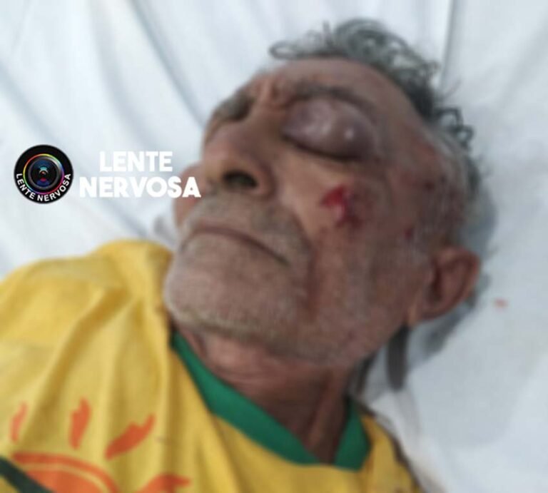 Idoso com afundamento de crânio aguarda mais de 12 horas por vaga no João Paulo II