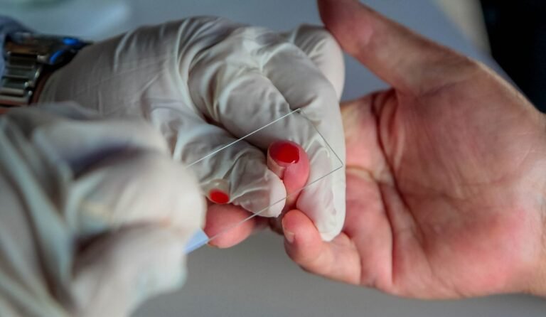 Últimas Notícias 1 Estudo sobre a implantação de medicamento inovador no tratamento da malária tem participação do Centro de Pesquisa de Rondônia