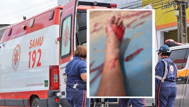 Últimas Notícias 2 Motorista do Samu sofre grave ferimento ao colidir em carro que realizava conversão proibida