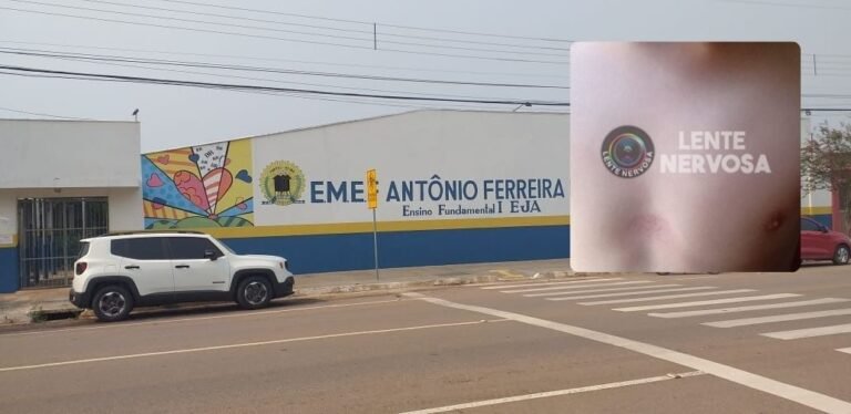 NEGLIGÊNCIA ESCOLAR – Mãe relata impotência diante de agressões sofridas pelo filho em escola municipal de Porto Velho