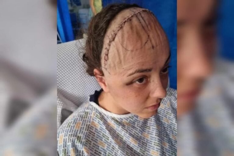 Últimas Notícias 8 Mulher que sentia sede e cansaço constantes descobre câncer no cérebro