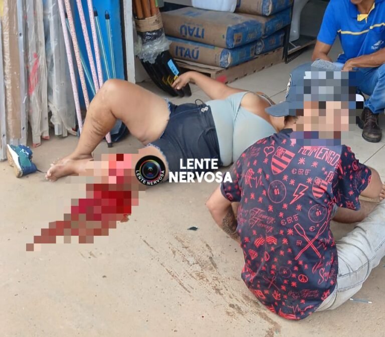 Mulher sofre gravíssimo ferimento em acidente na Avenida Campos Sales