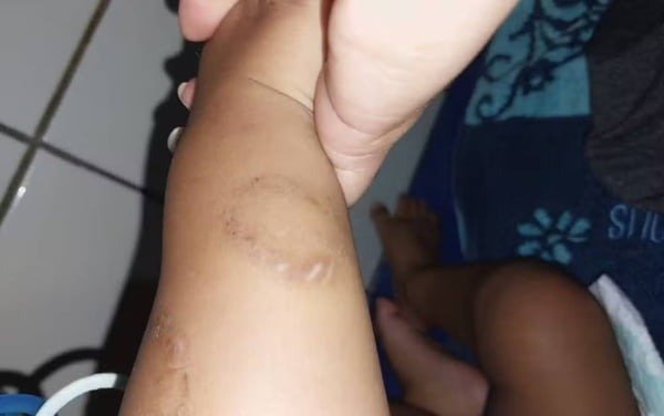 Mãe e padrasto são suspeitos de tortura contra bebê de 1 ano em Goiás 1 Mãe e padrasto são suspeitos de tortura contra bebê de 1 ano em Goiás