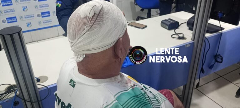 Populares espancam suspeito de tentar matar homem durante assalto no Skate Parque