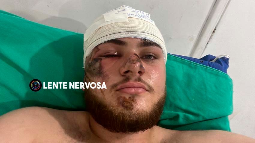 SE RECUPERA BEM – Jovem que foi projetado de carro durante capotamento deverá ser transferido de hospital – VEJA FOTOS 8 SE RECUPERA BEM – Jovem que foi projetado de carro durante capotamento deverá ser transferido de hospital – VEJA FOTOS