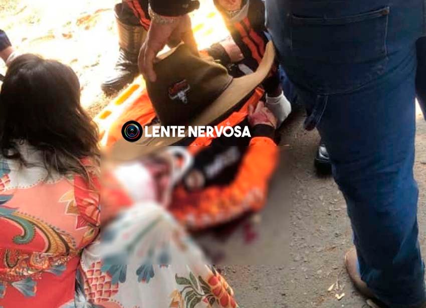 SE RECUPERA BEM – Jovem que foi projetado de carro durante capotamento deverá ser transferido de hospital – VEJA FOTOS