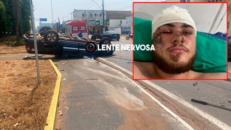 SE RECUPERA BEM – Jovem que foi projetado de carro durante capotamento deverá ser transferido de hospital – VEJA FOTOS