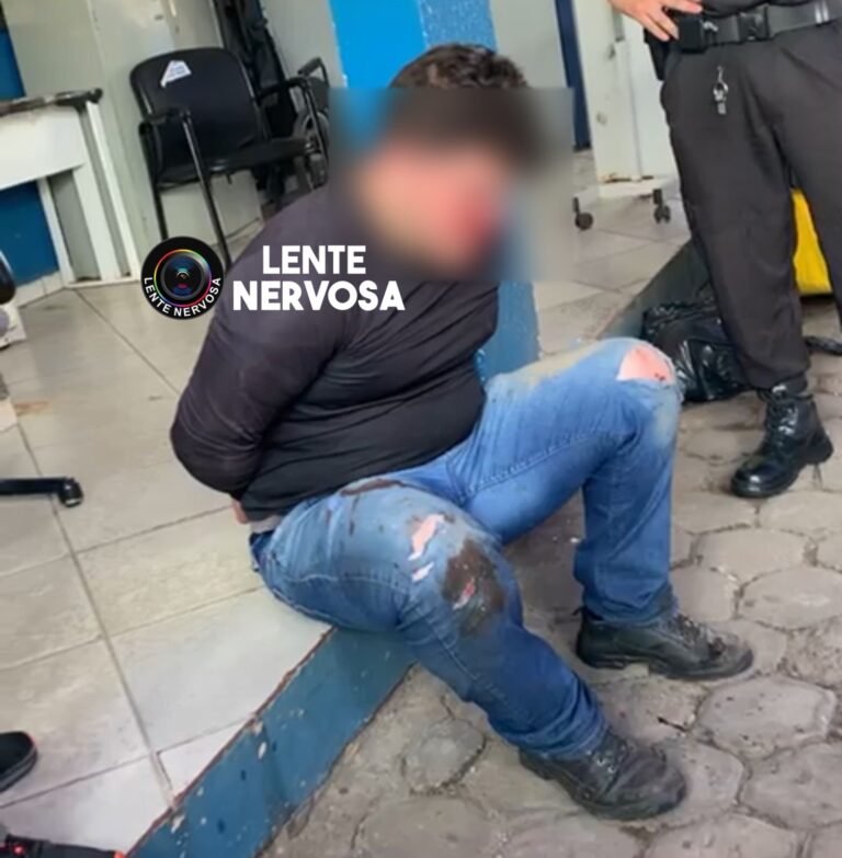 Mulher fica gravemente ferida ao ser esfaqueada 31 vezes pelo ex-marido