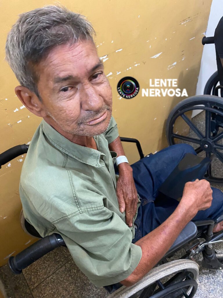 INOCENTE – Baleado no pé, vítima de ataque na zona Leste morre na UPA