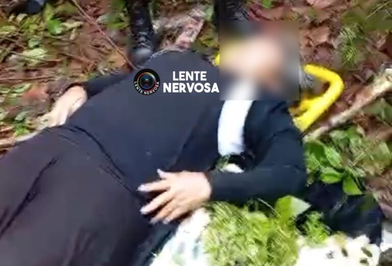 Idoso de 62 anos teve que amputar duas pernas após capotar caminhonete na BR-364 – VEJA VÍDEO